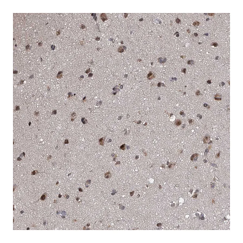 Atlas Antibodies Anti-PRPF3 Antibody
