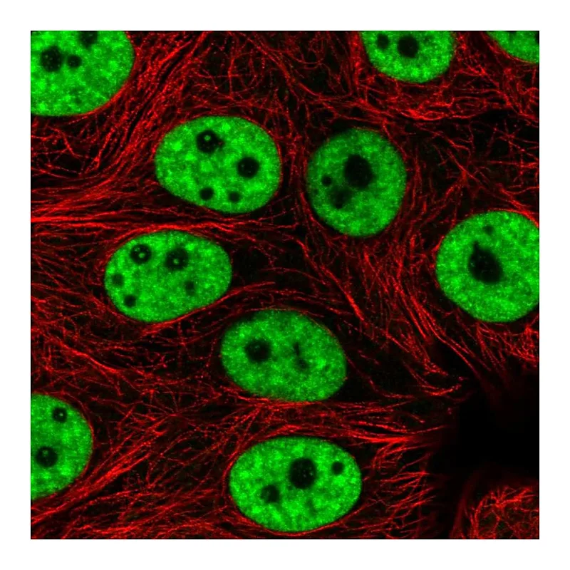 Atlas Antibodies Anti-PRPF3 Antibody