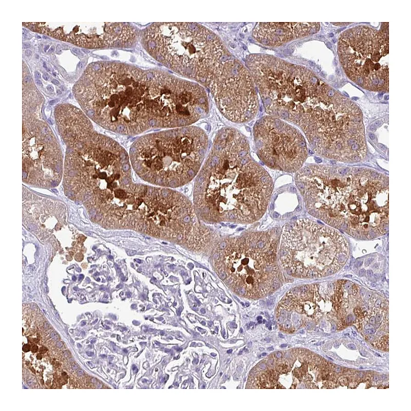 Atlas Antibodies Anti-PRPF38A Antibody