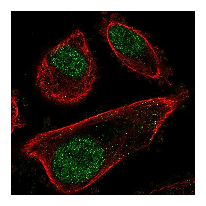 Atlas Antibodies Anti-PRPF31 Antibody
