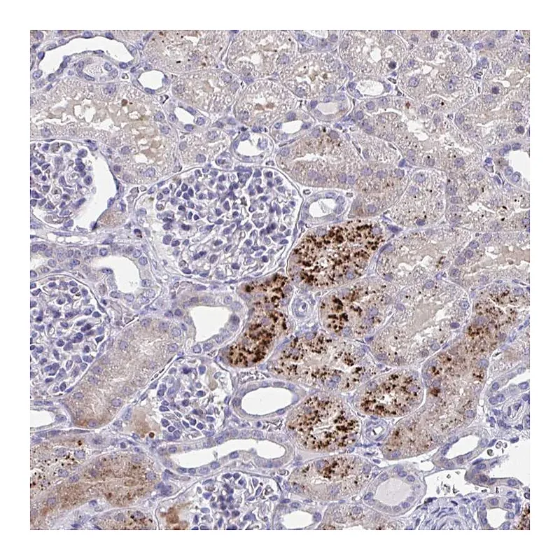Atlas Antibodies Anti-PRPF38A Antibody