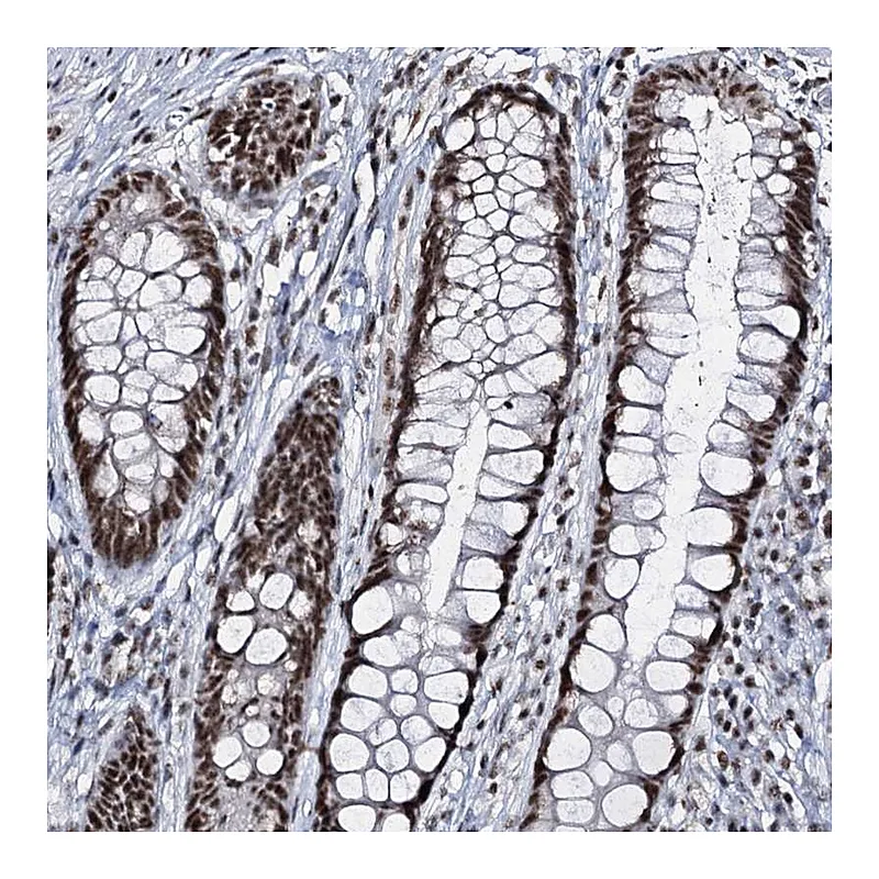 Atlas Antibodies Anti-PRPF40A Antibody