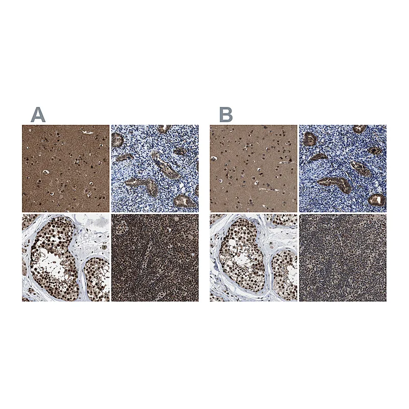 Atlas Antibodies Anti-PRPF4 Antibody