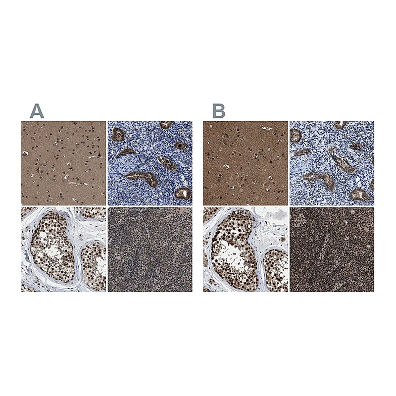 Atlas Antibodies Anti-PRPF4 Antibody