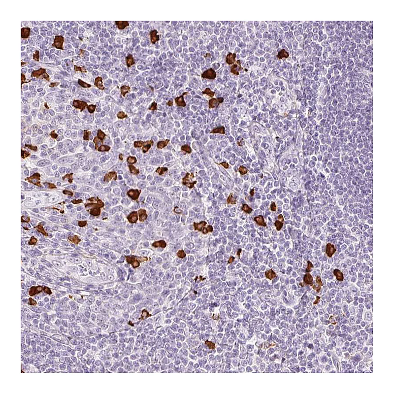 Atlas Antibodies Anti-PRPF38B Antibody