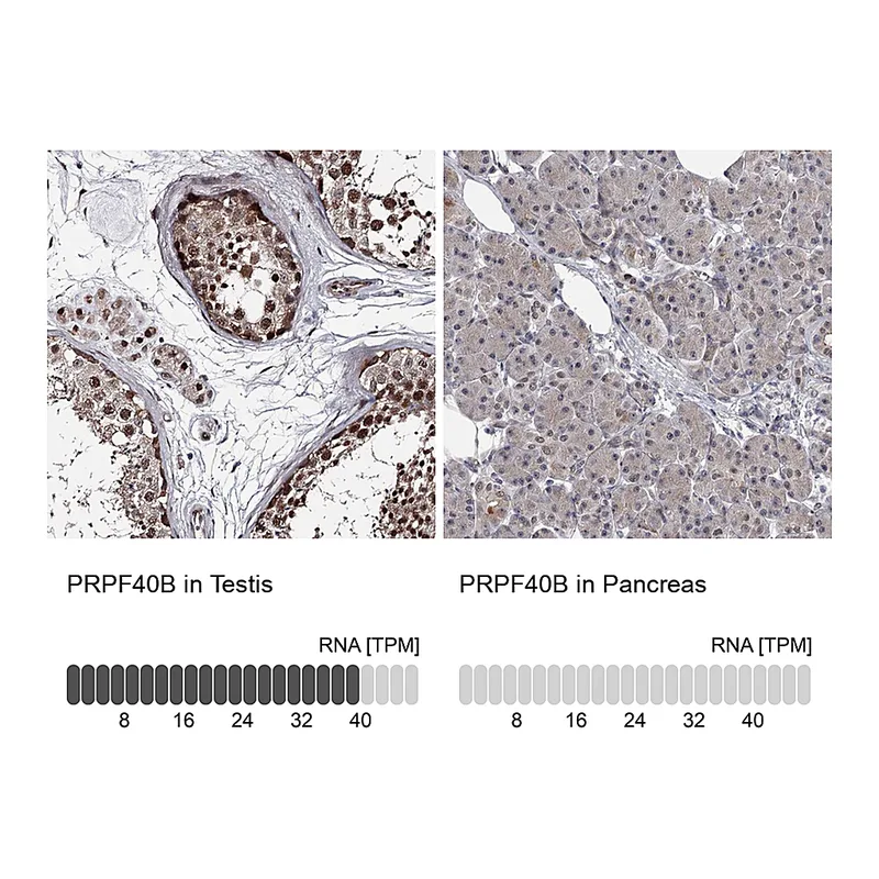 Atlas Antibodies Anti-PRPF40B Antibody