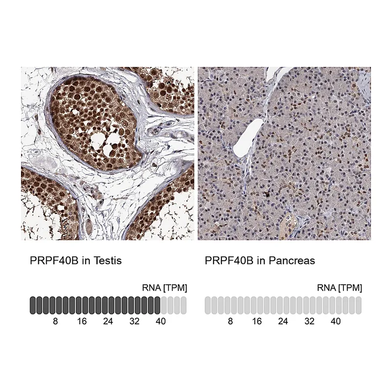 Atlas Antibodies Anti-PRPF40B Antibody