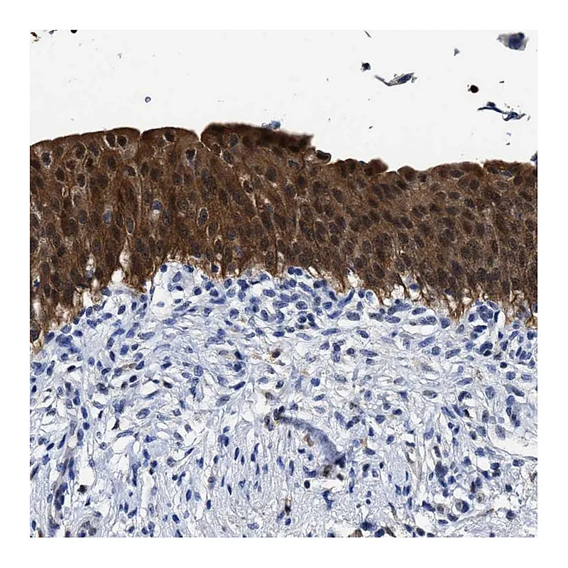 Atlas Antibodies Anti-PRPF4B Antibody