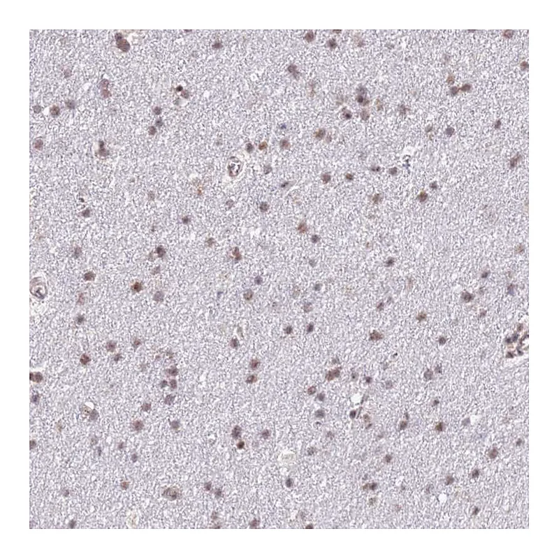Atlas Antibodies Anti-PRPF6 Antibody