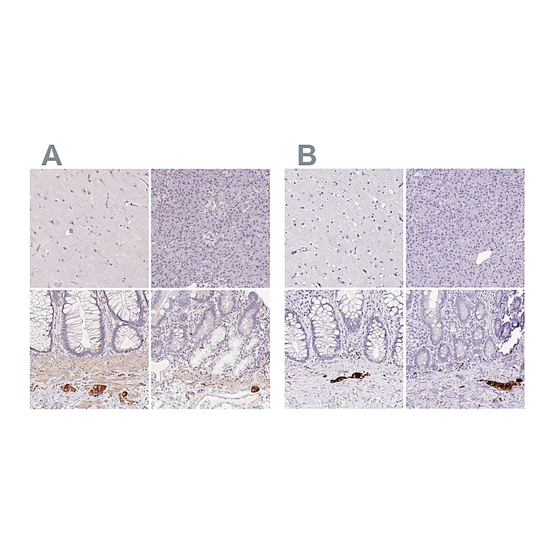 Atlas Antibodies Anti-PRPH Antibody