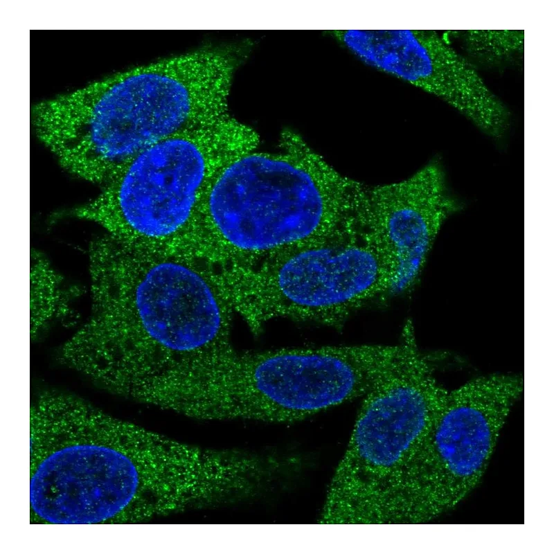 Atlas Antibodies Anti-PRPSAP1 Antibody