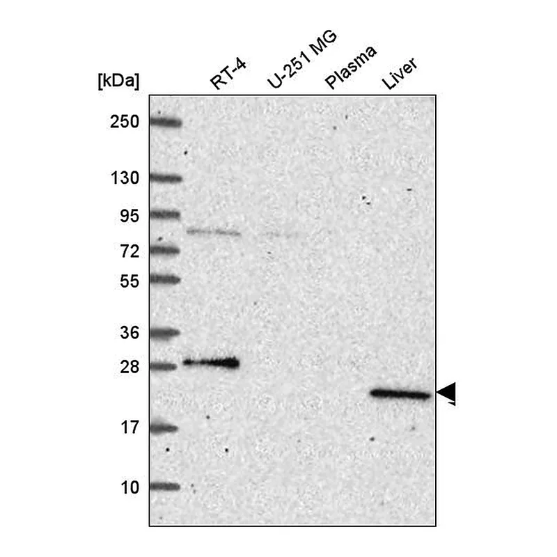 Atlas Antibodies Anti-PRPS2 Antibody