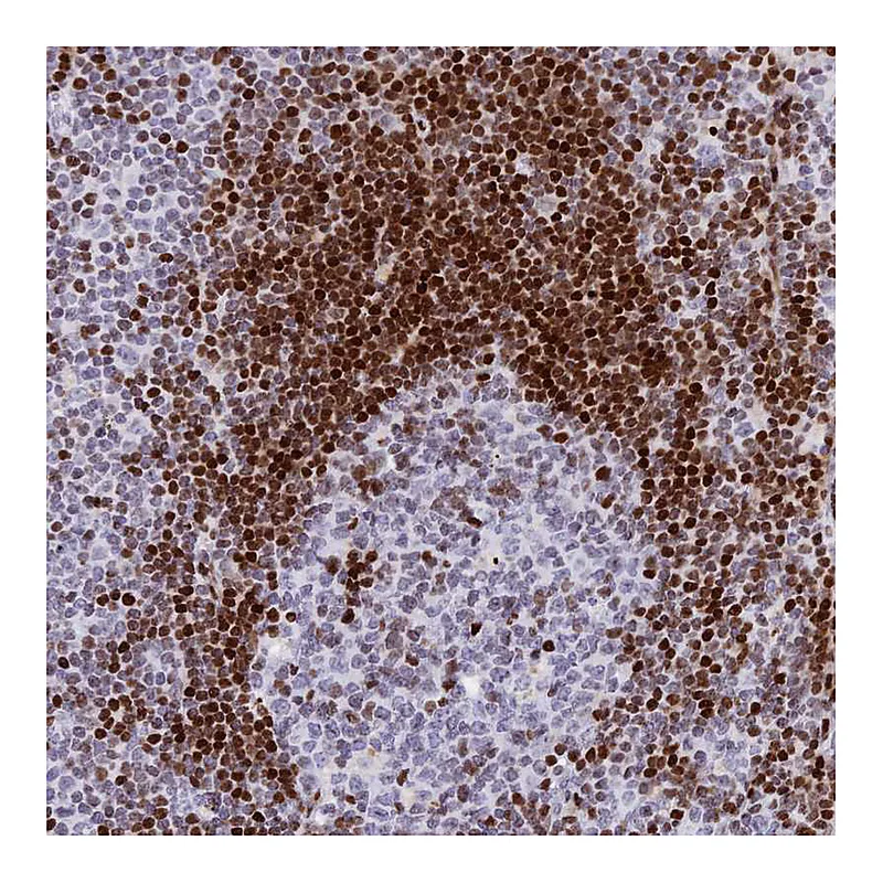 Atlas Antibodies Anti-PRPS1 Antibody