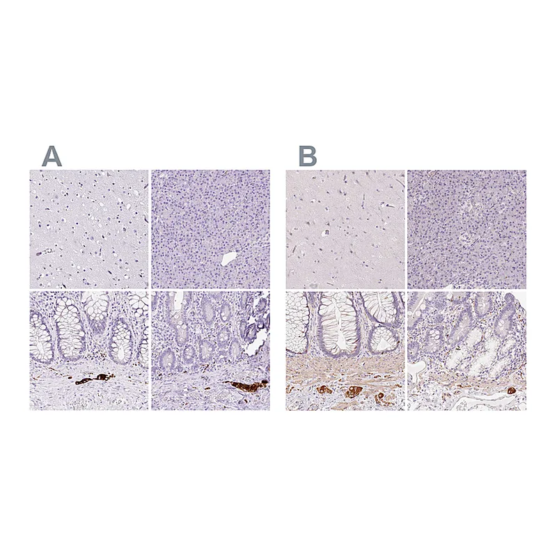 Atlas Antibodies Anti-PRPH Antibody