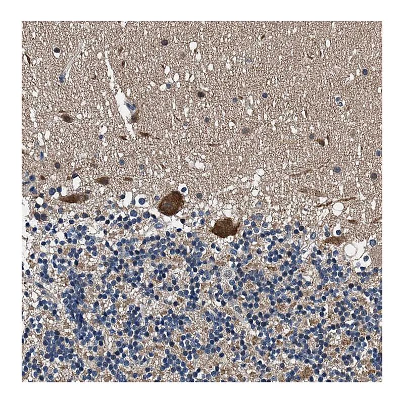 Atlas Antibodies Anti-PRPSAP2 Antibody
