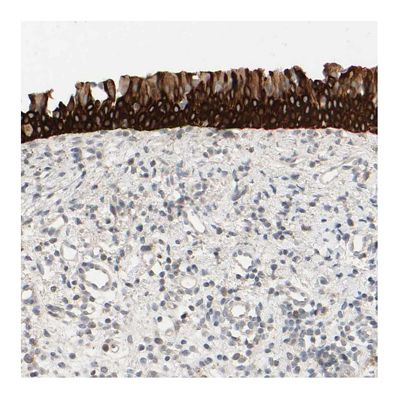 Atlas Antibodies Anti-PRR11 Antibody