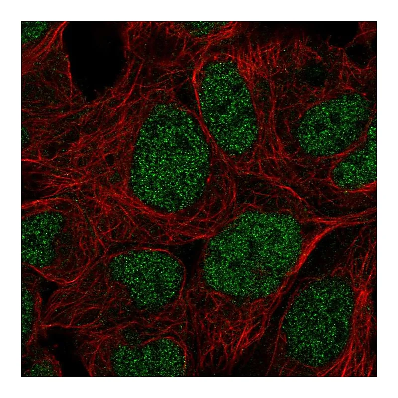 Atlas Antibodies Anti-PRR14 Antibody