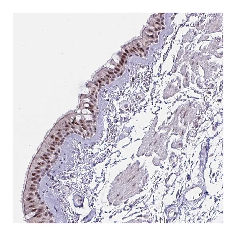 Atlas Antibodies Anti-PRR14 Antibody
