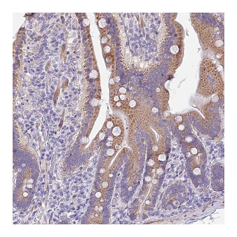 Atlas Antibodies Anti-PRR13 Antibody