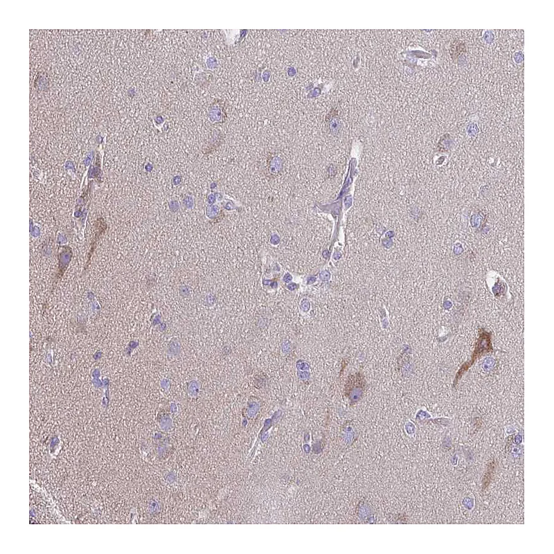Atlas Antibodies Anti-PRR14L Antibody