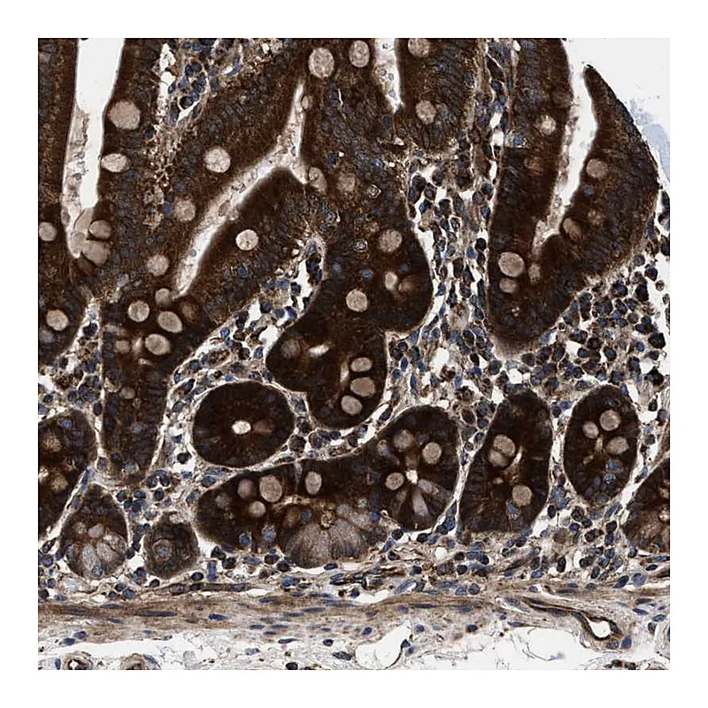 Atlas Antibodies Anti-PRR15L Antibody