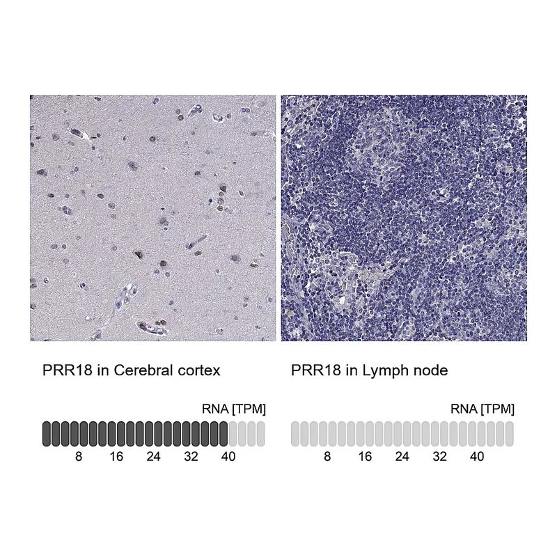 Atlas Antibodies Anti-PRR18 Antibody