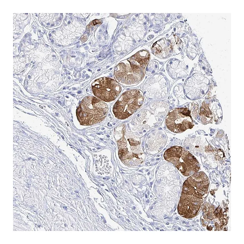 Atlas Antibodies Anti-PRR20A Antibody