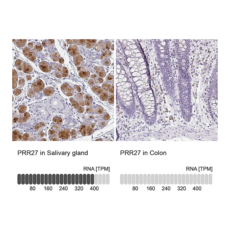 Atlas Antibodies Anti-PRR27 Antibody