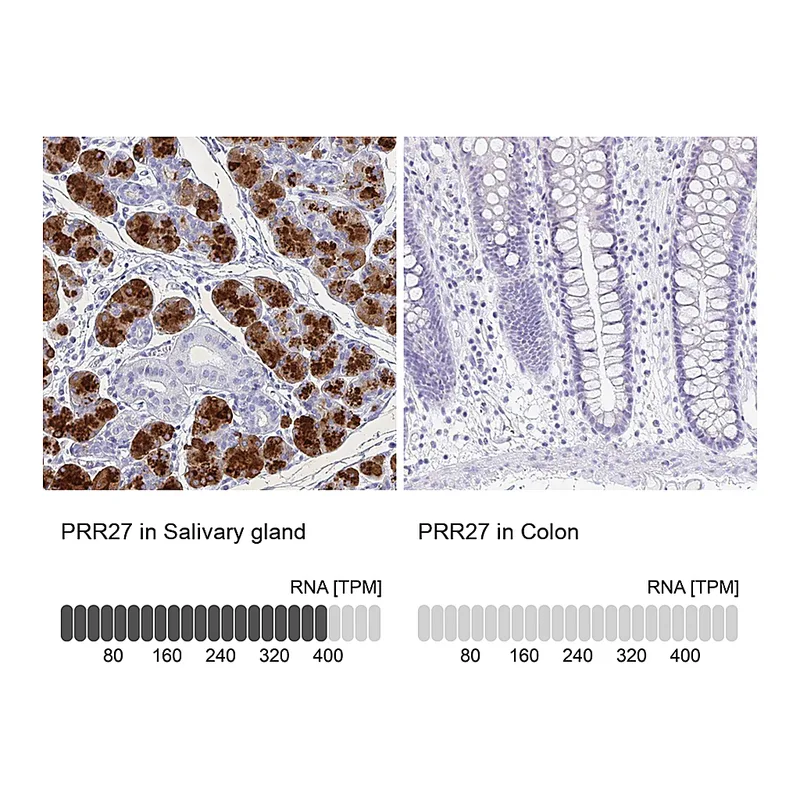 Atlas Antibodies Anti-PRR27 Antibody
