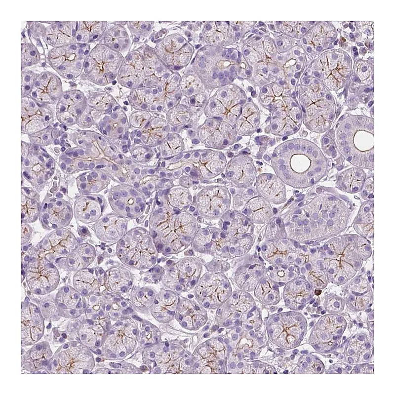 Atlas Antibodies Anti-PRR35 Antibody