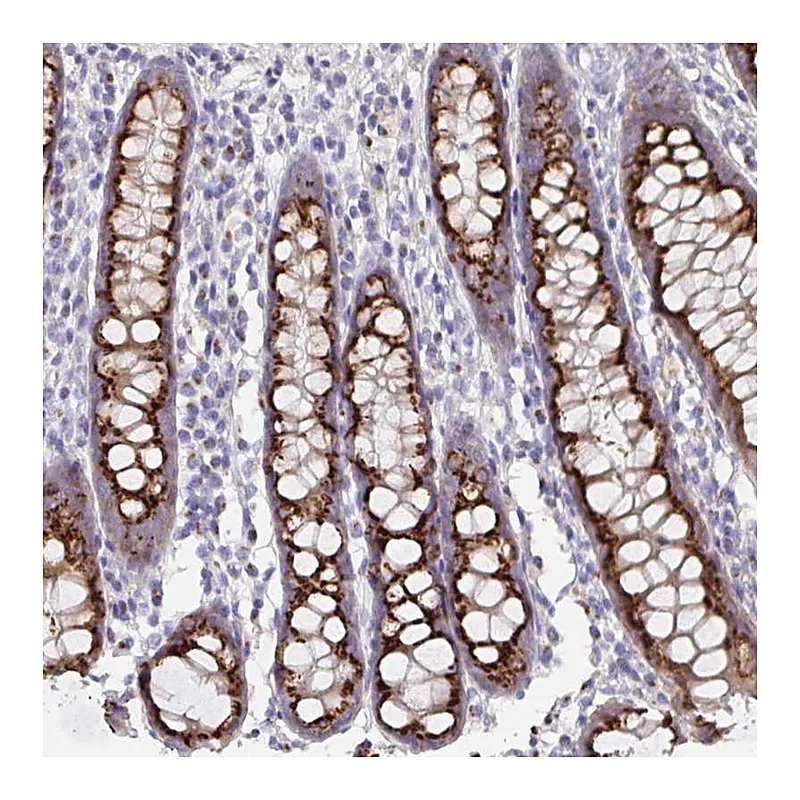 Atlas Antibodies Anti-PRR36 Antibody