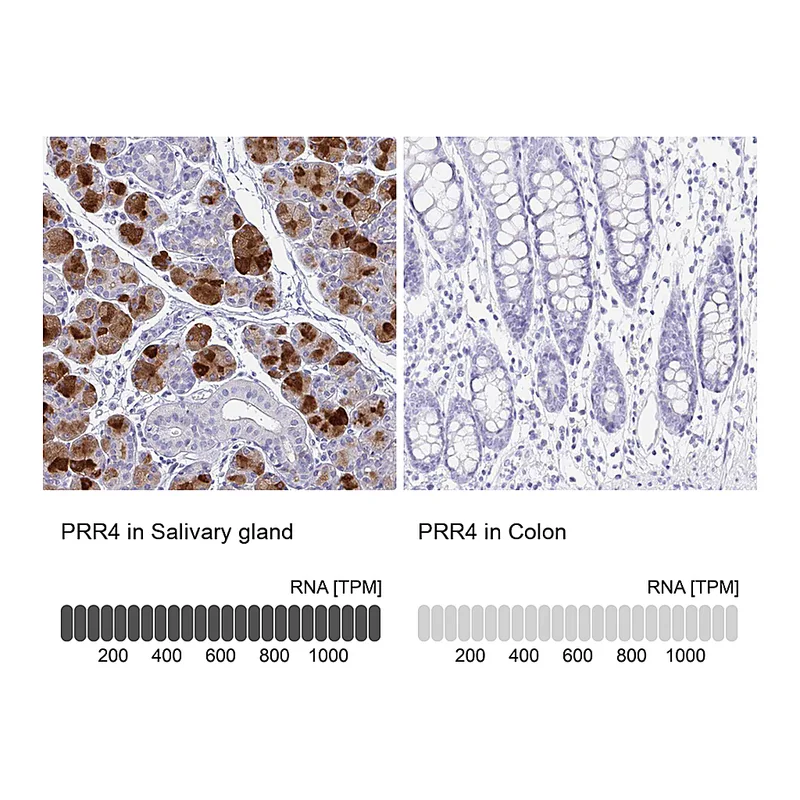 Atlas Antibodies Anti-PRR4 Antibody
