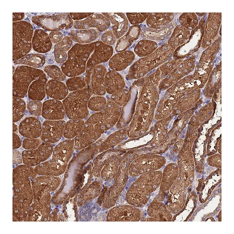 Atlas Antibodies Anti-PRR32 Antibody