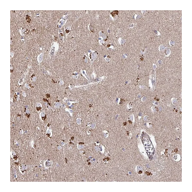 Atlas Antibodies Anti-PRR5 Antibody