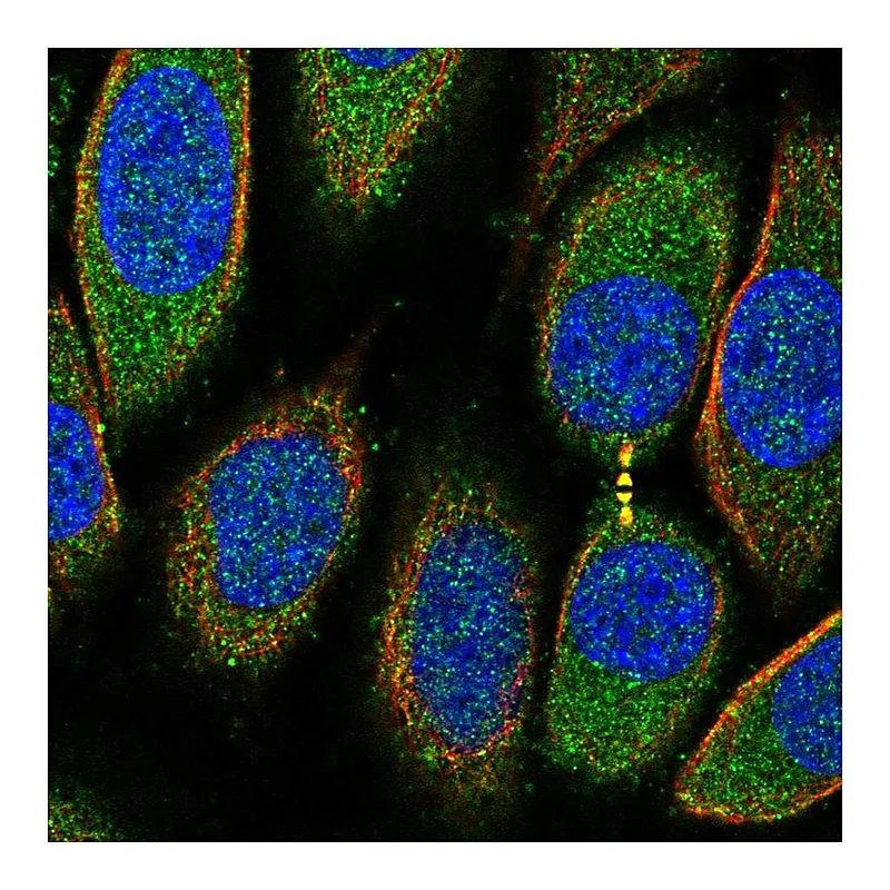 Atlas Antibodies Anti-PRR5L Antibody