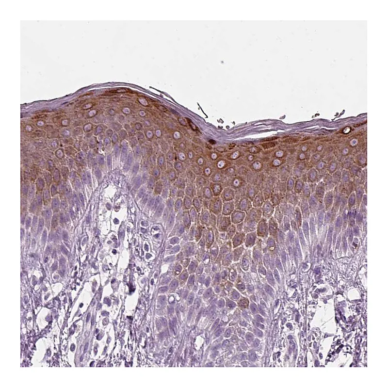 Atlas Antibodies Anti-PRR9 Antibody