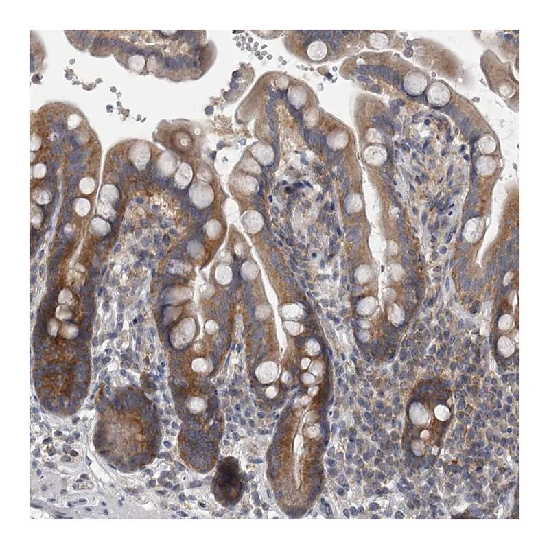 Atlas Antibodies Anti-PRRC2C Antibody