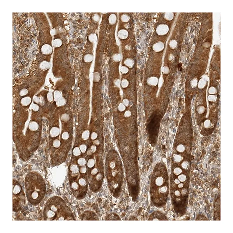 Atlas Antibodies Anti-PRRC2C Antibody