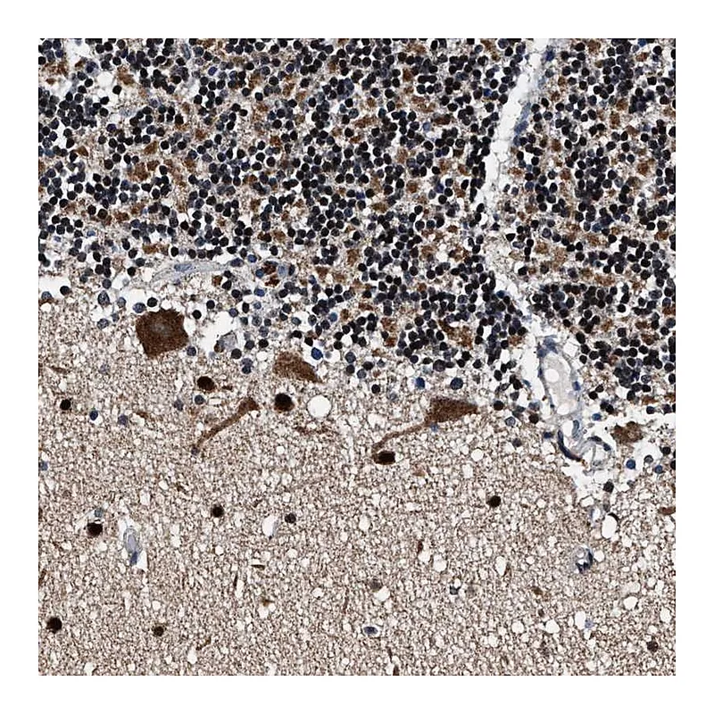 Atlas Antibodies Anti-PRRC2B Antibody