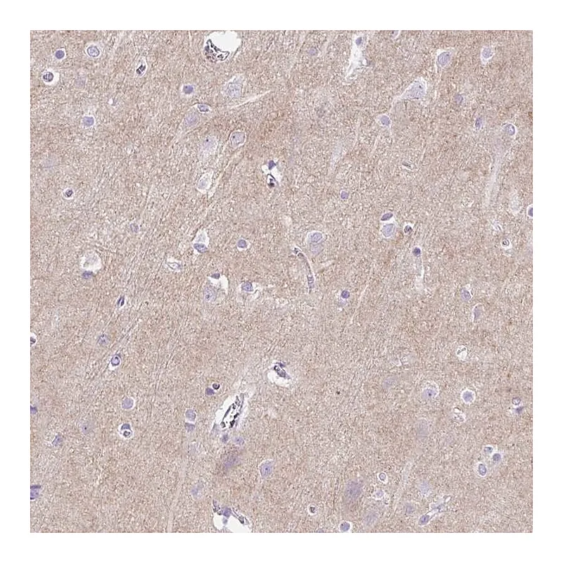 Atlas Antibodies Anti-PRRT1 Antibody