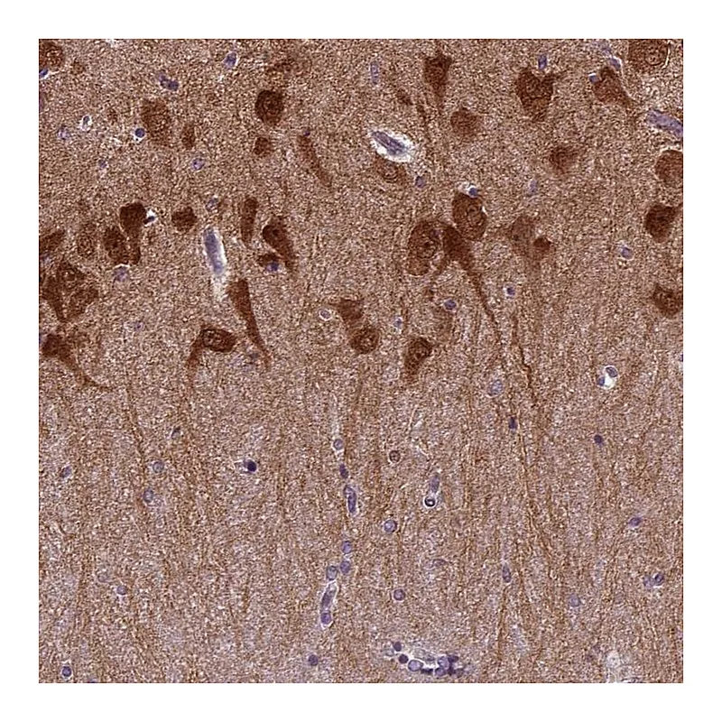 Atlas Antibodies Anti-PRRT1 Antibody