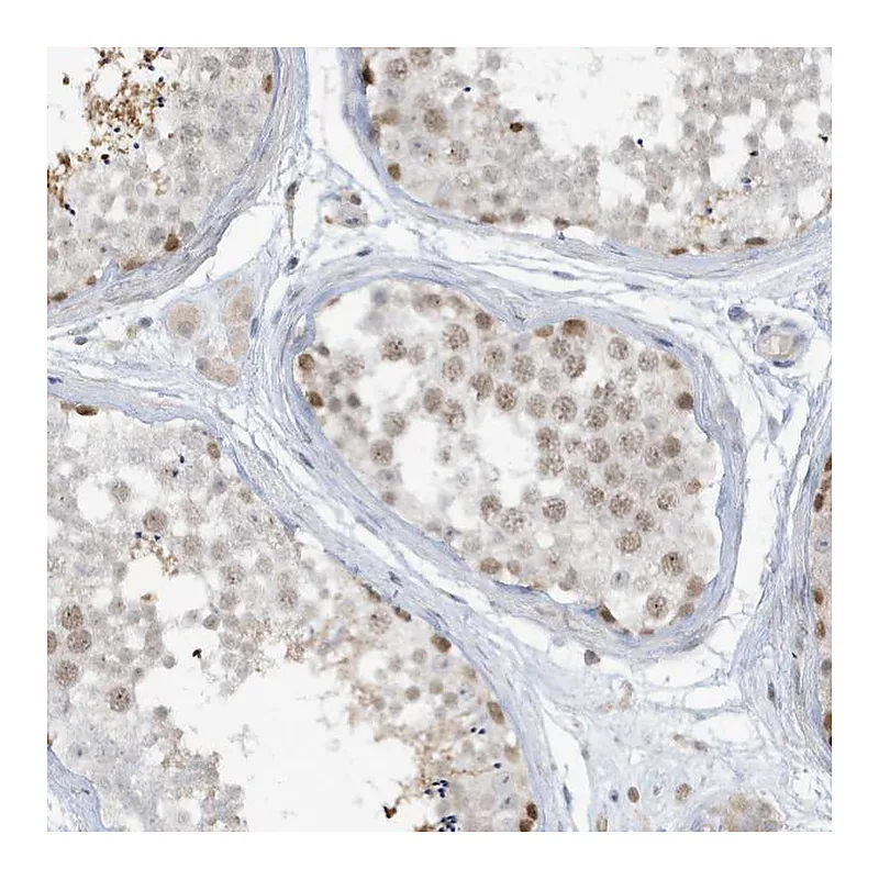 Atlas Antibodies Anti-PRRT3 Antibody