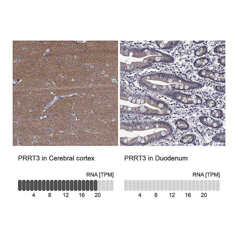 Atlas Antibodies Anti-PRRT3 Antibody