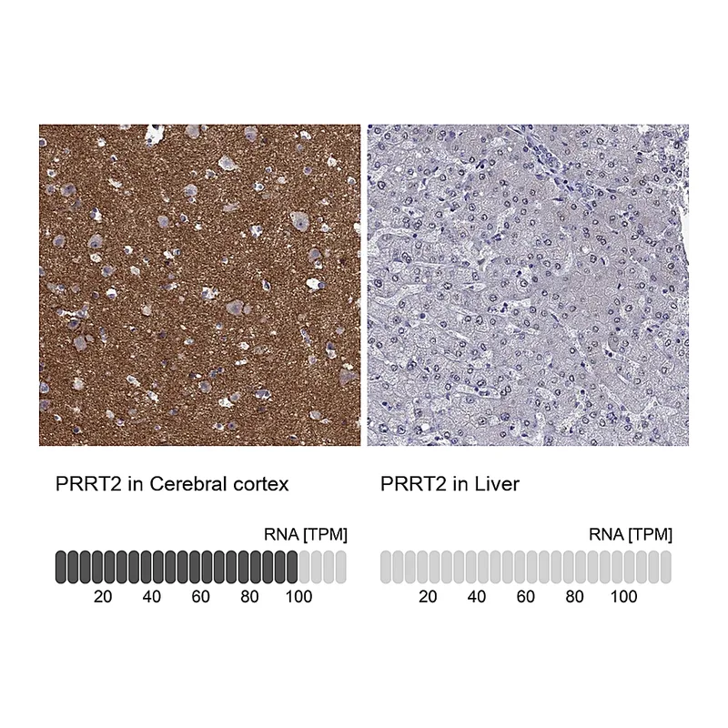 Atlas Antibodies Anti-PRRT2 Antibody