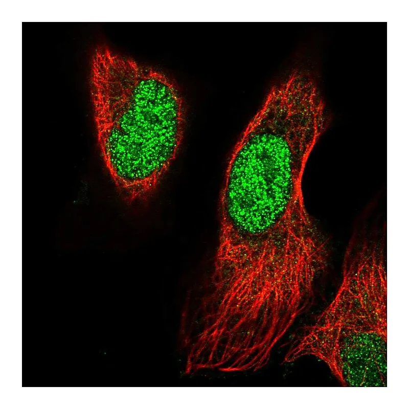 Atlas Antibodies Anti-PRRX1 Antibody