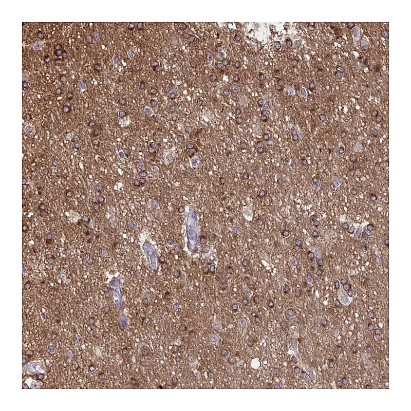 Atlas Antibodies Anti-PRRT4 Antibody