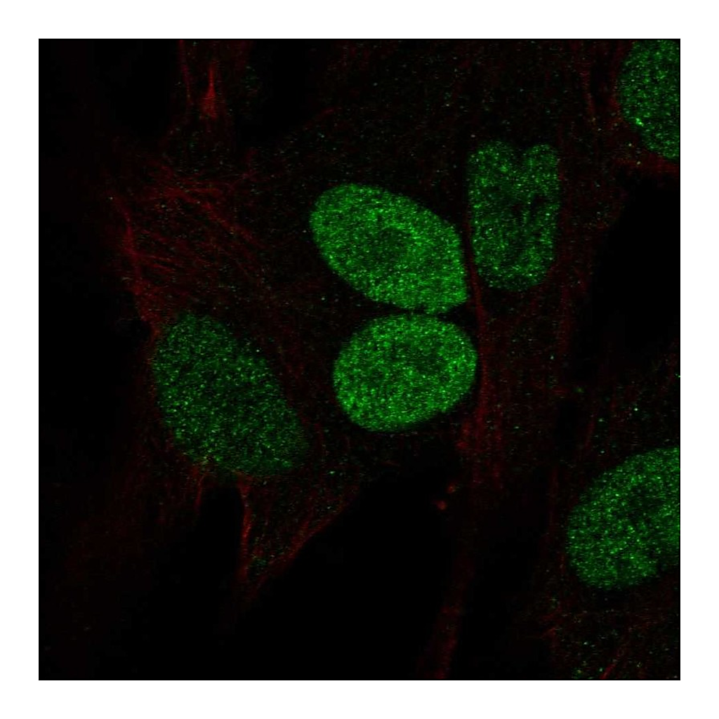 Atlas Antibodies Anti-PRRX2 Antibody