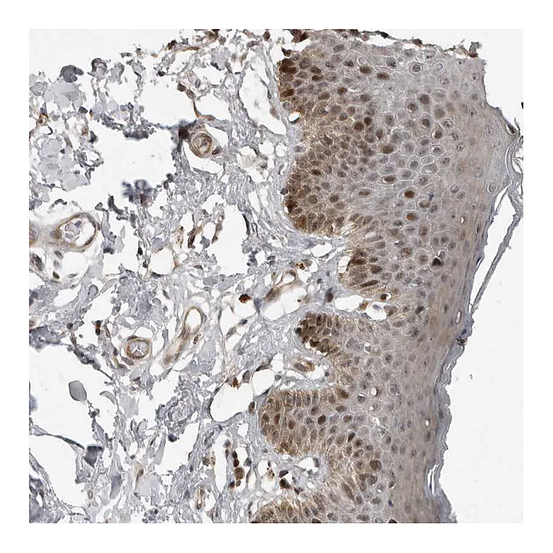 Atlas Antibodies Anti-PRRX2 Antibody