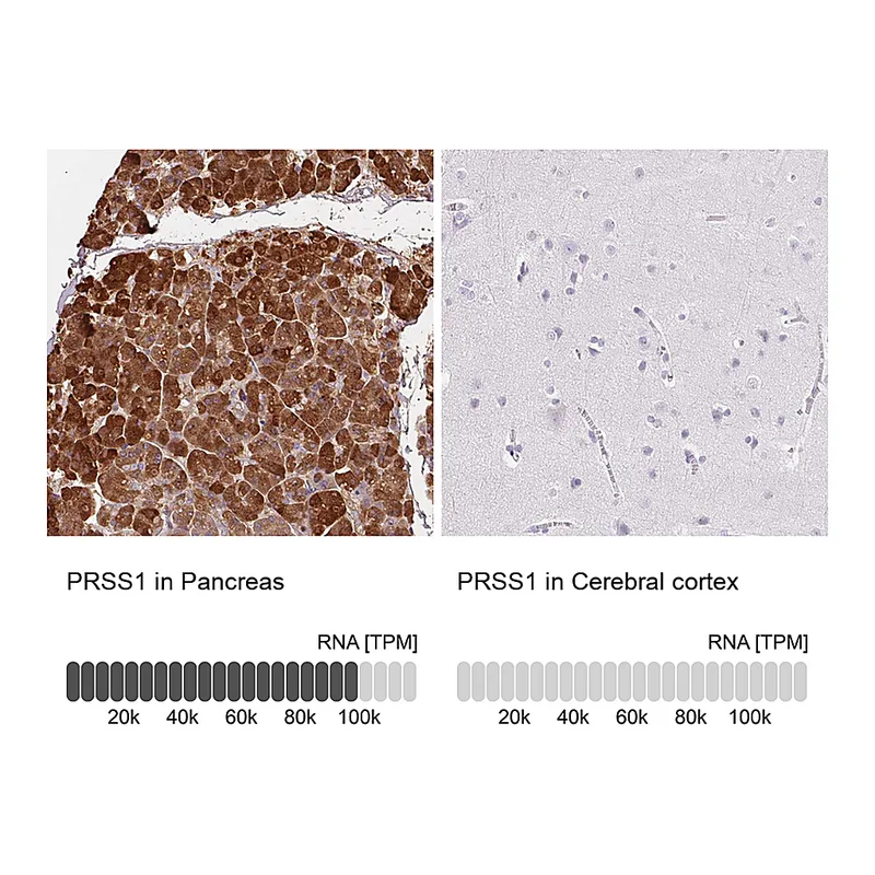 Atlas Antibodies Anti-PRSS1 Antibody