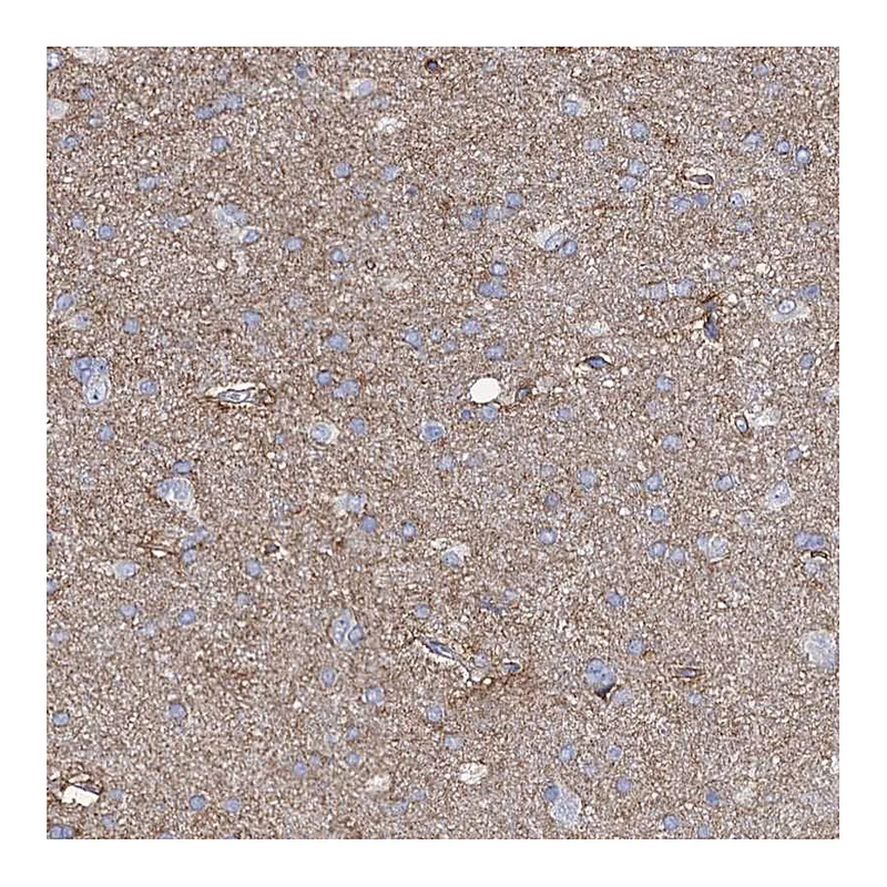 Atlas Antibodies Anti-PRSS35 Antibody